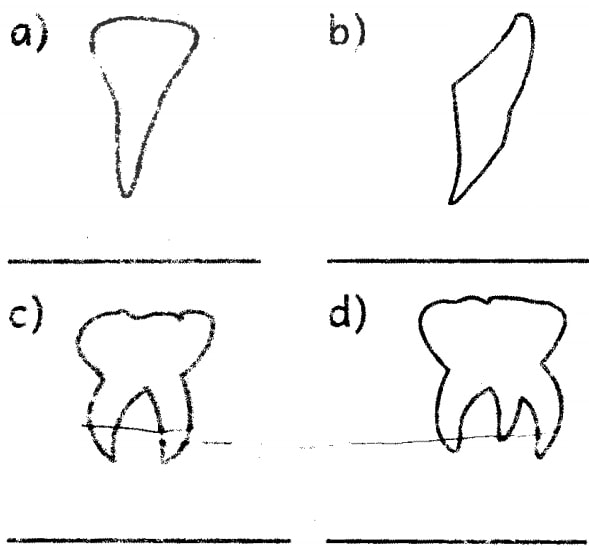 teeth