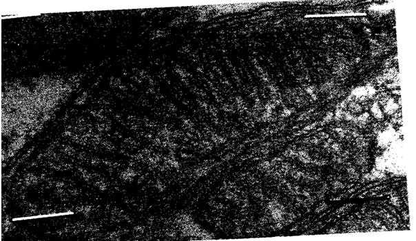 electron micrograph photo
